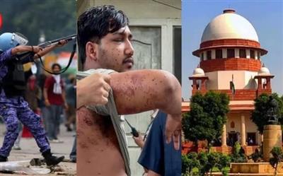 पैलेट गन कांड: नेता प्रतिपक्ष के धरने पर बैठने के बाद हिली पुलिस की कुर्सी, लिखनी पड़ी एफ.आई.आर.!